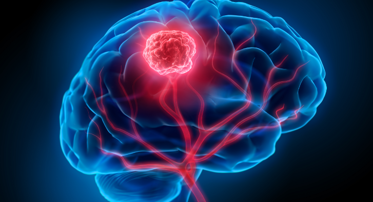 中醫對腫瘤的認識